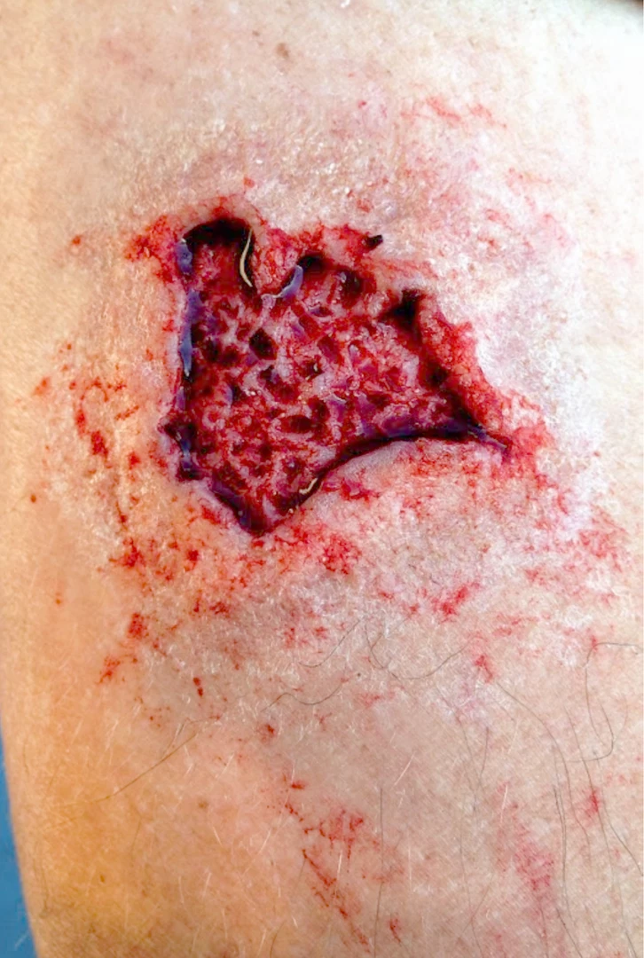 Monster Paste Prosthetic Mold #1 Prosthetics 1 Monster Paste Prosthetic Mold #1 Prosthetics