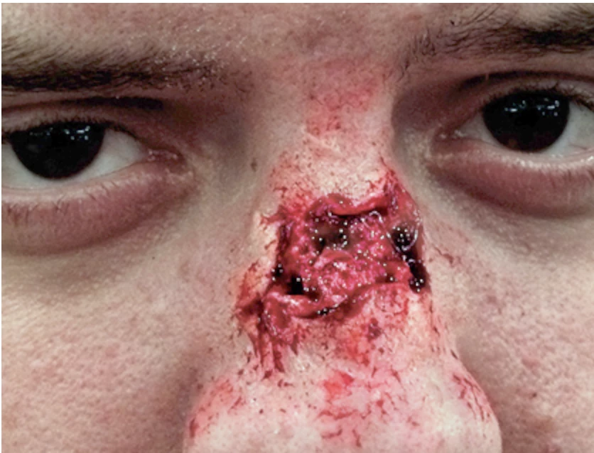 Monster Paste Prosthetic Mold #4 1 Monster Paste Prosthetic Mold #4