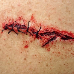 Monster Paste Prosthetic Mold #5- Stitch Prosthetics