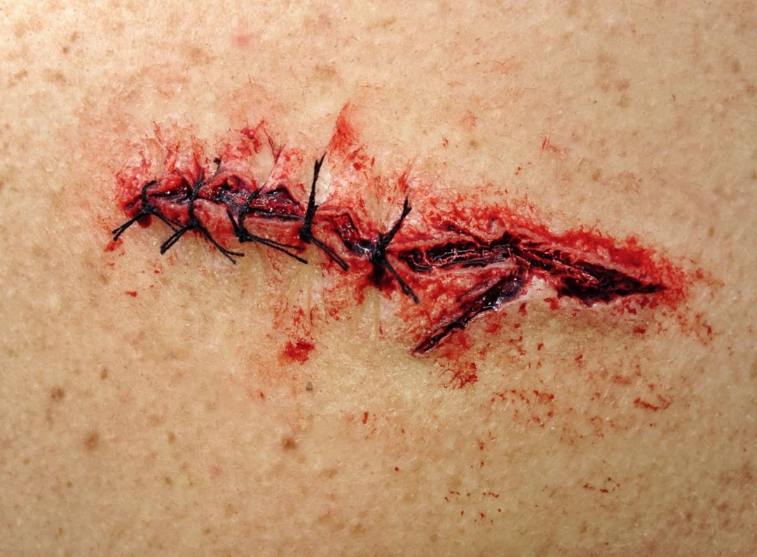 Monster Paste Prosthetic Mold #5- Stitch Prosthetics 1 Monster Paste Prosthetic Mold #5- Stitch Prosthetics