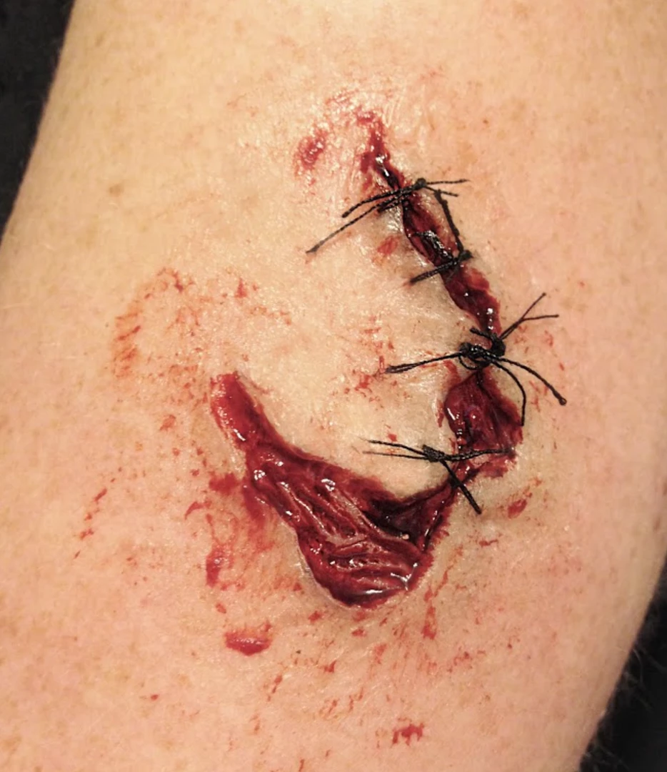 Monster Paste Prosthetic Mold #6- Stitch 2 1 Monster Paste Prosthetic Mold #6- Stitch 2