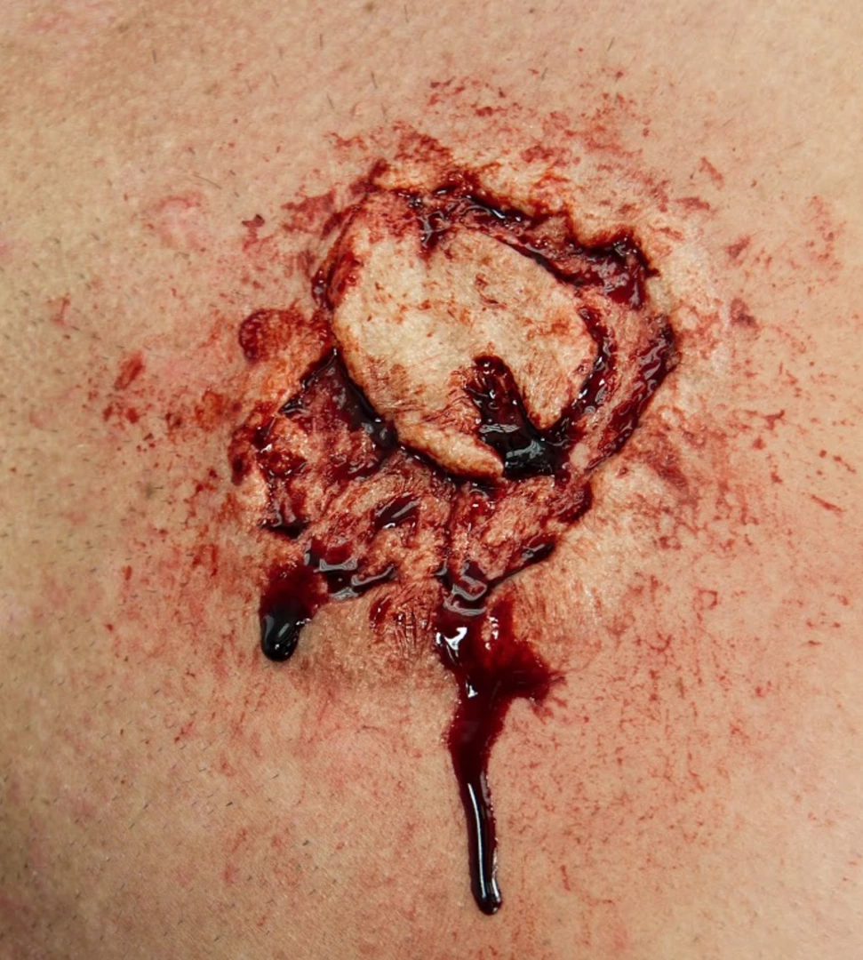 Prosthetics Monster Paste Prosthetic Mold #8- Zombie Bite 2 1 Prosthetics Monster Paste Prosthetic Mold #8- Zombie Bite 2