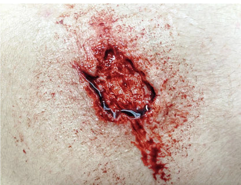 Monster Paste Prosthetic Mold #10 1 Monster Paste Prosthetic Mold #10